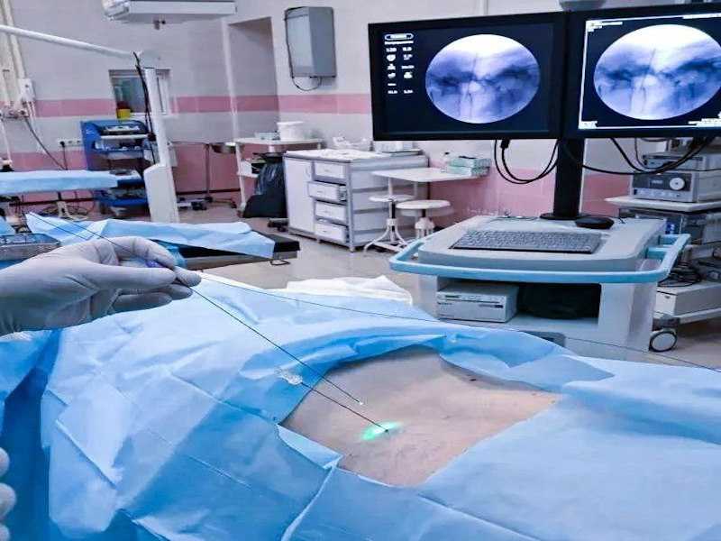  Лазер для лечения межпозвонковых грыж начали применять в НОКБ им. Н.А.Семашко.