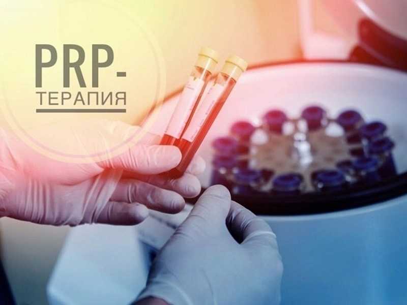 Лечение аутологичной обогащенной тромбоцитарной плазмой